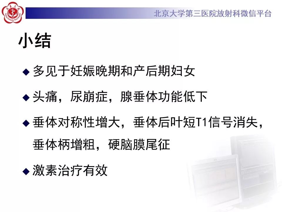 【病例】淋巴细胞性垂体炎2例MR