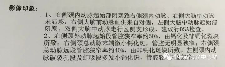 脑白质病变 Fazekas 分级 脑白质病变 Fazekas 分级