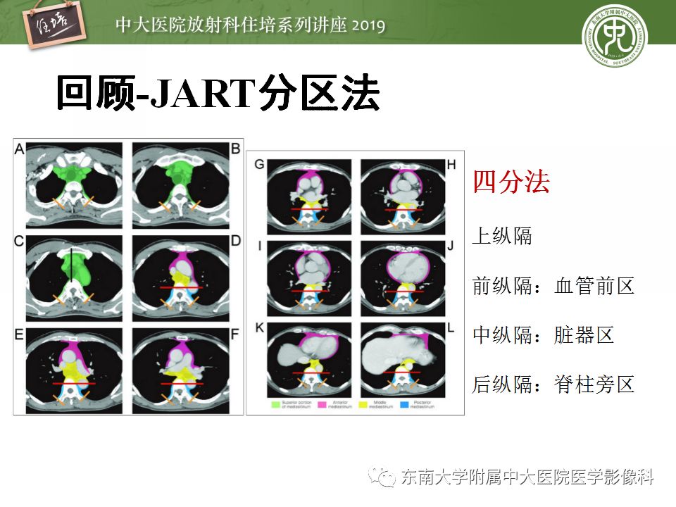 【PPT】纵隔分区及常见纵隔占位的影像诊断