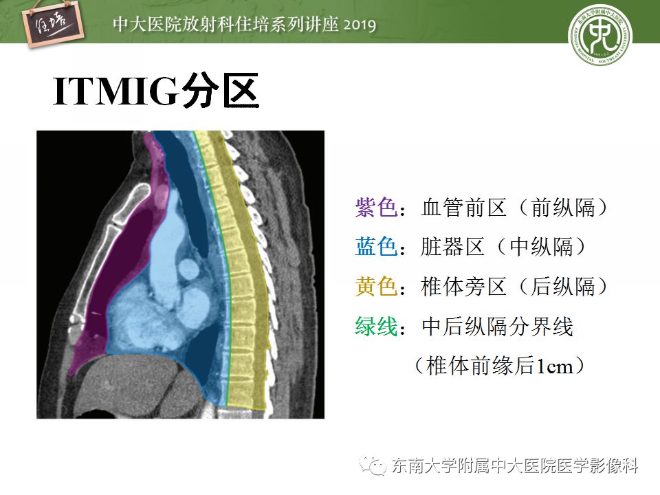 【PPT】纵隔分区及常见纵隔占位的影像诊断