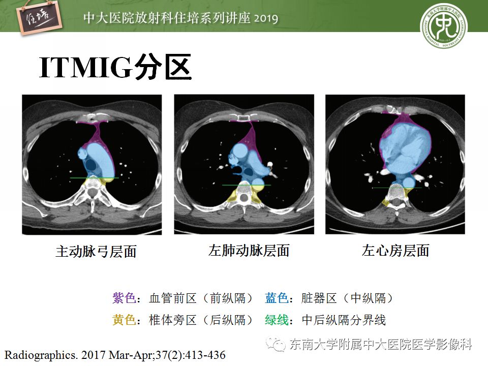 【PPT】纵隔分区及常见纵隔占位的影像诊断