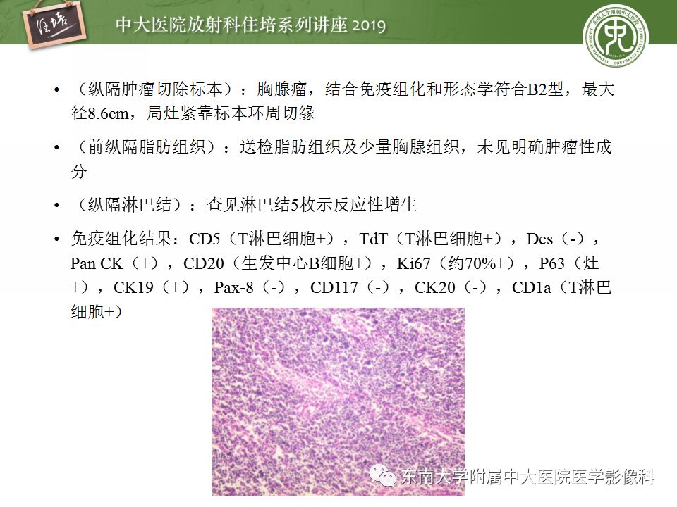 【PPT】纵隔分区及常见纵隔占位的影像诊断