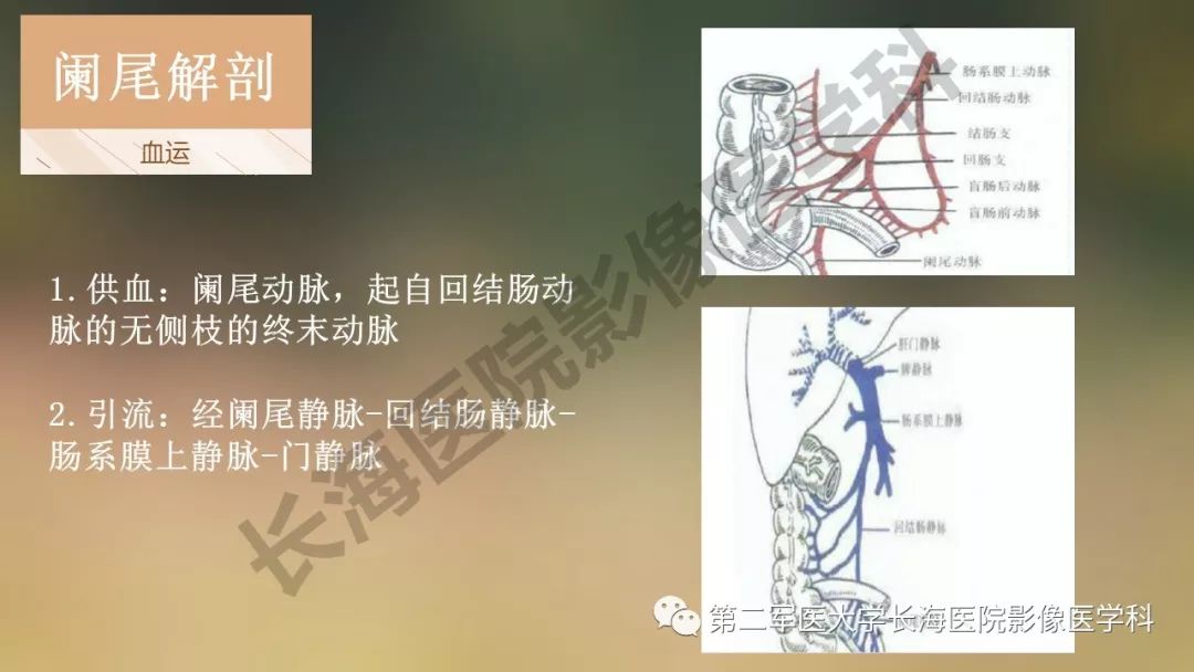 【PPT】阑尾常见原发肿瘤影像学表现