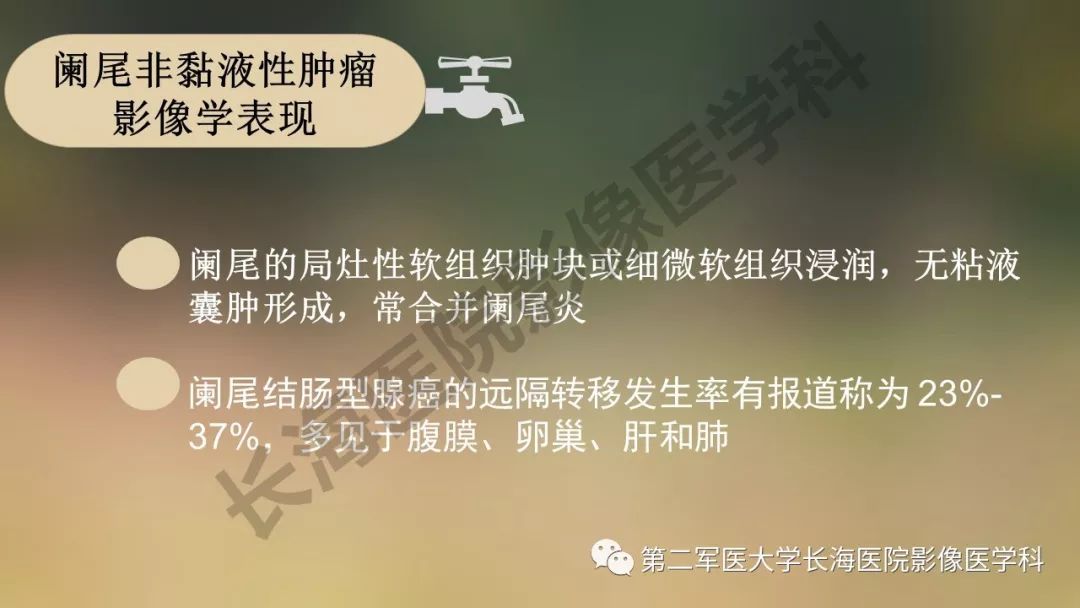 【PPT】阑尾常见原发肿瘤影像学表现