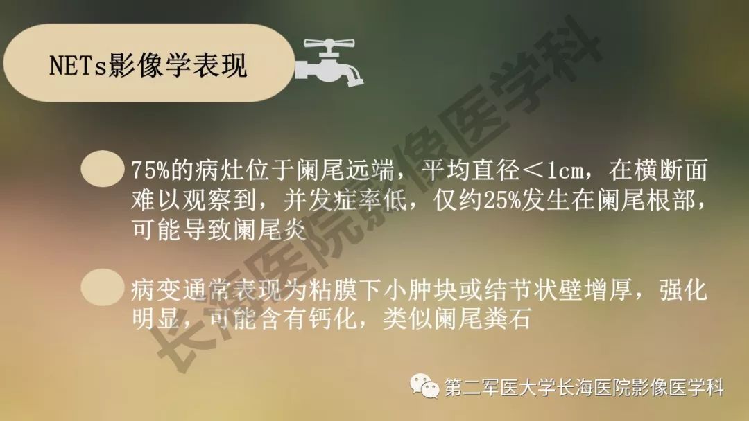 【PPT】阑尾常见原发肿瘤影像学表现