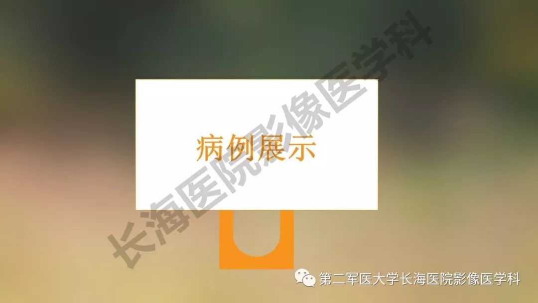【PPT】阑尾常见原发肿瘤影像学表现