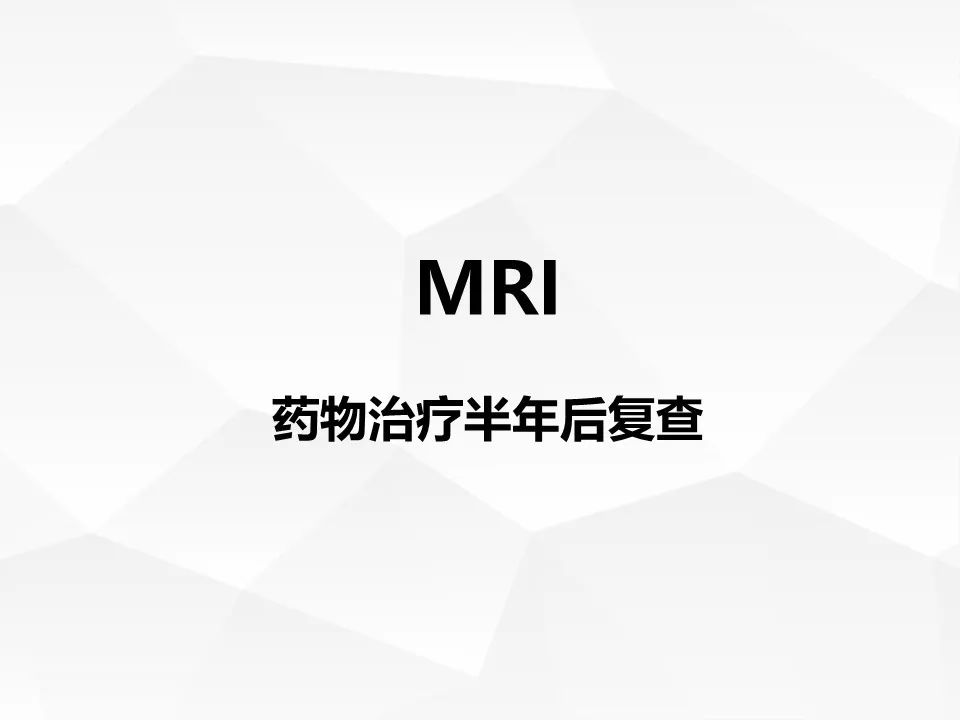 【病例】腹腔多发炎性肌纤维母细胞瘤IMT1例