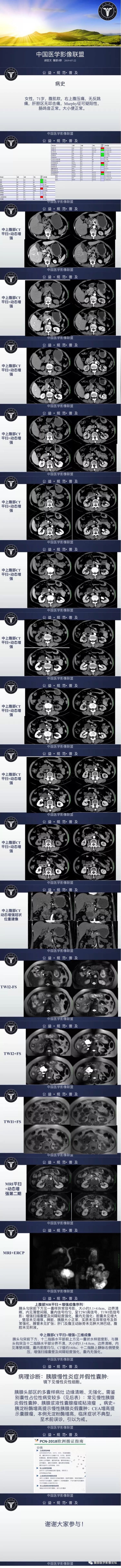【病例】慢性胰腺炎伴胰腺假性囊肿形成1例CT及MR