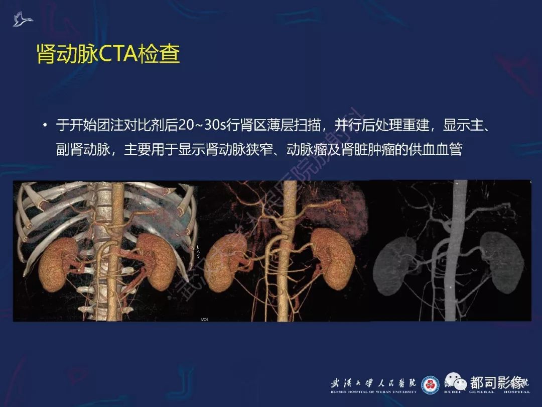 【PPT】常见肾脏肿瘤影像诊断