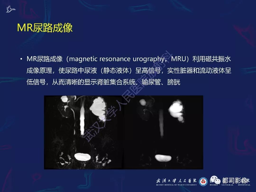 【PPT】常见肾脏肿瘤影像诊断