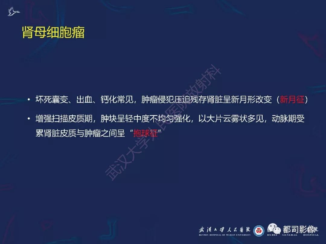【PPT】常见肾脏肿瘤影像诊断