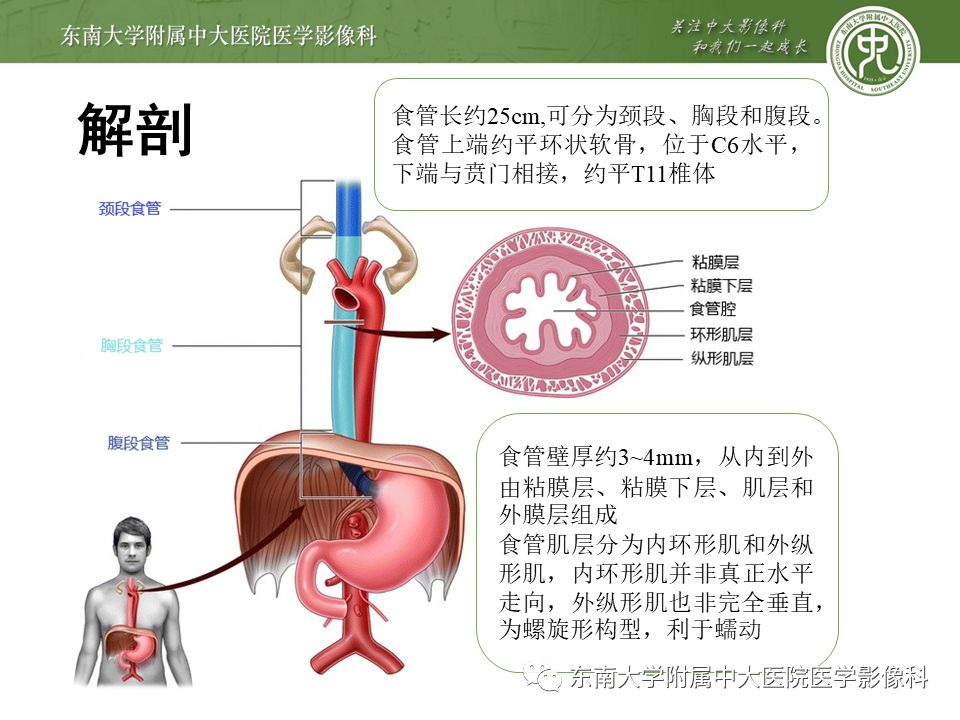 【病例】食管平滑肌瘤1例CT影像