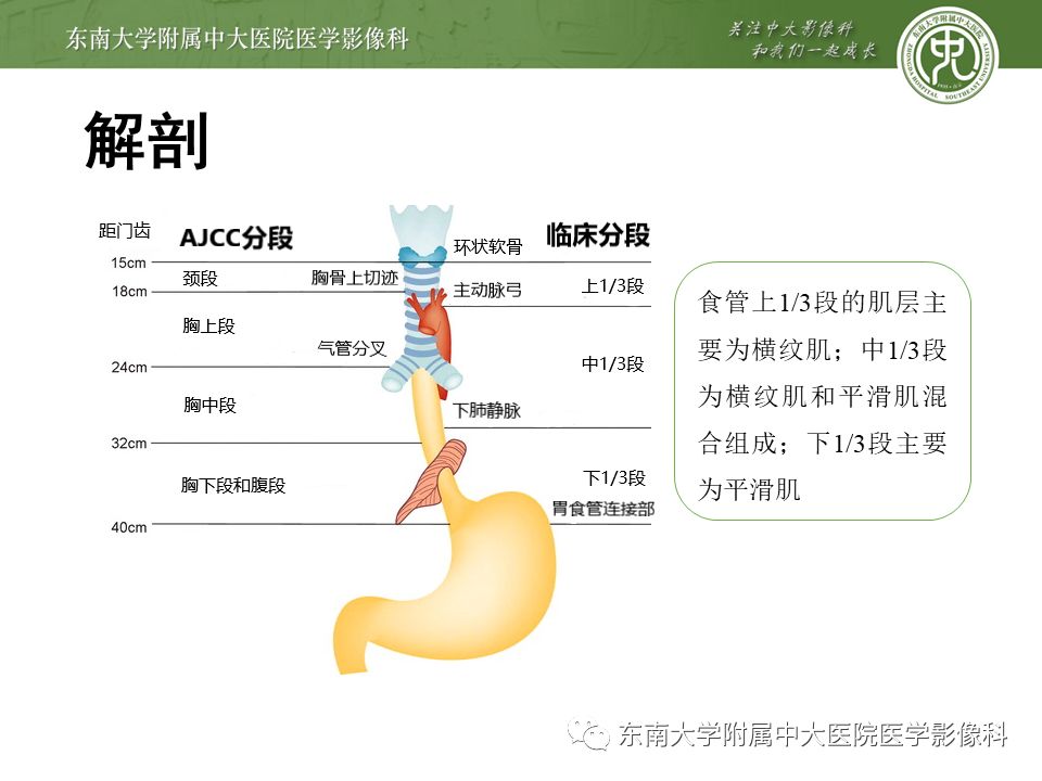 【病例】食管平滑肌瘤1例CT影像