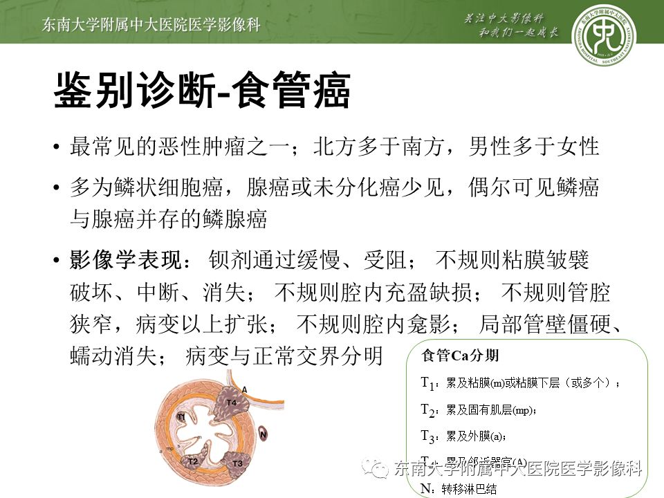 【病例】食管平滑肌瘤1例CT影像