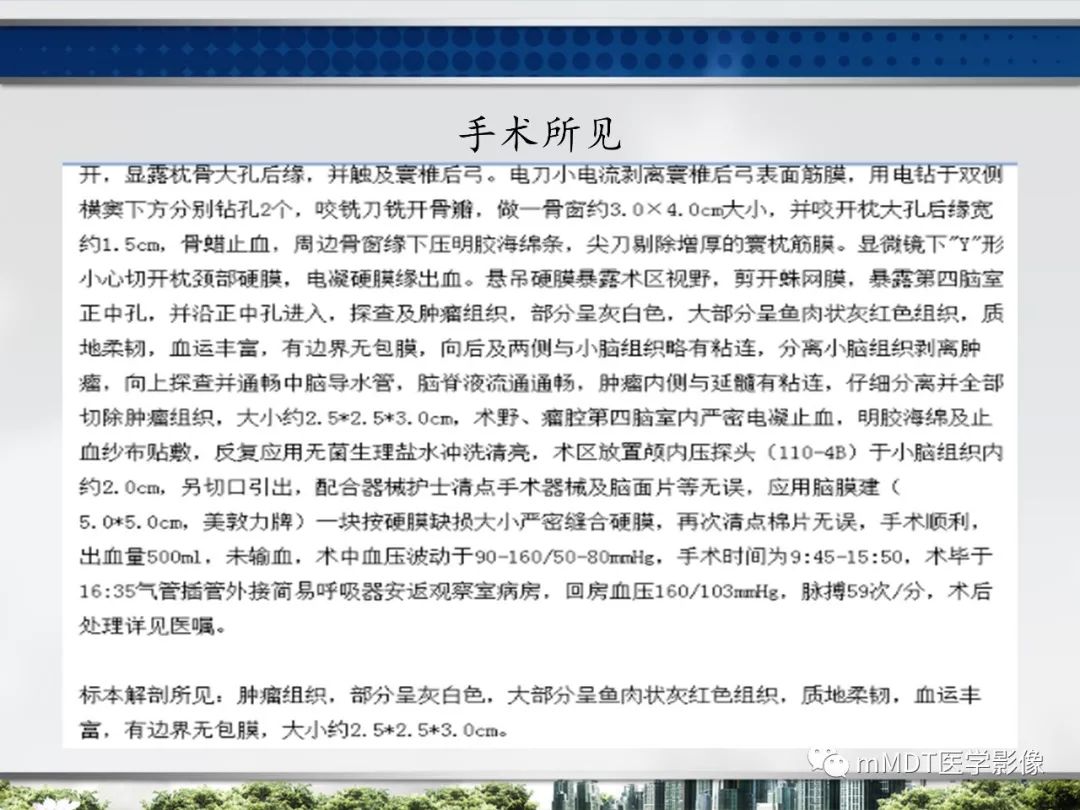 【PPT】四脑室肿瘤影像诊断与鉴别诊断