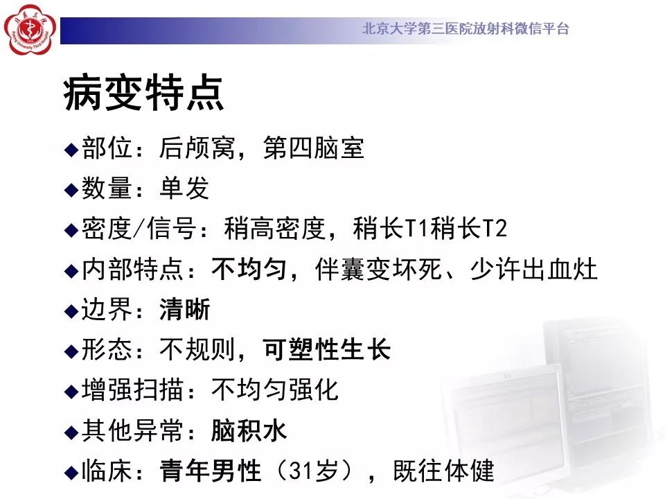 【病例】四脑室室管膜瘤1例CT及MR