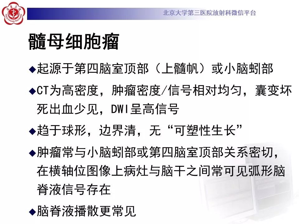 【病例】四脑室室管膜瘤1例CT及MR