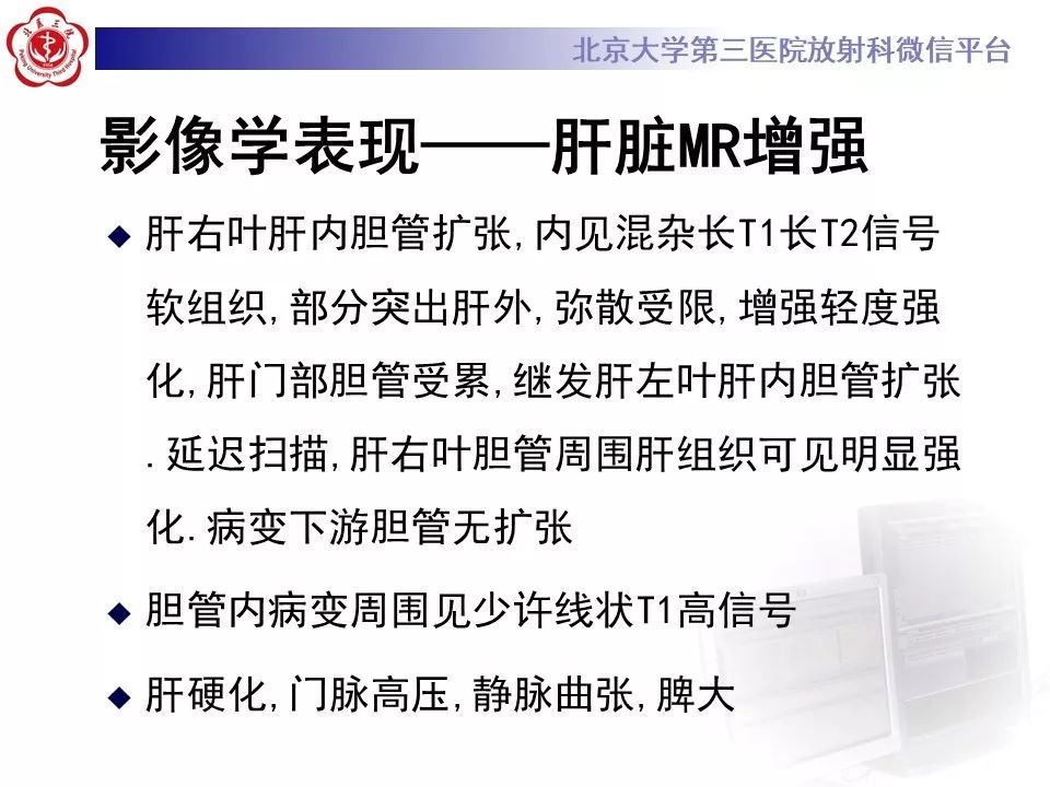【病例】肝内胆管导管内乳头状肿瘤1例CT及MR
