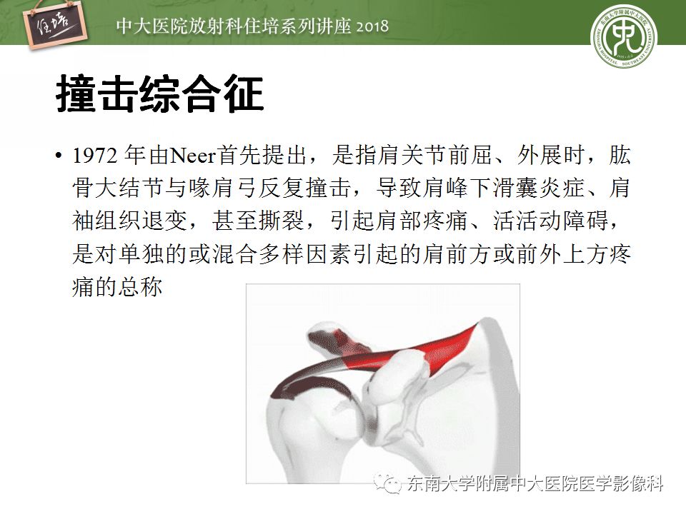 【PPT】肩关节病变影像诊断分析