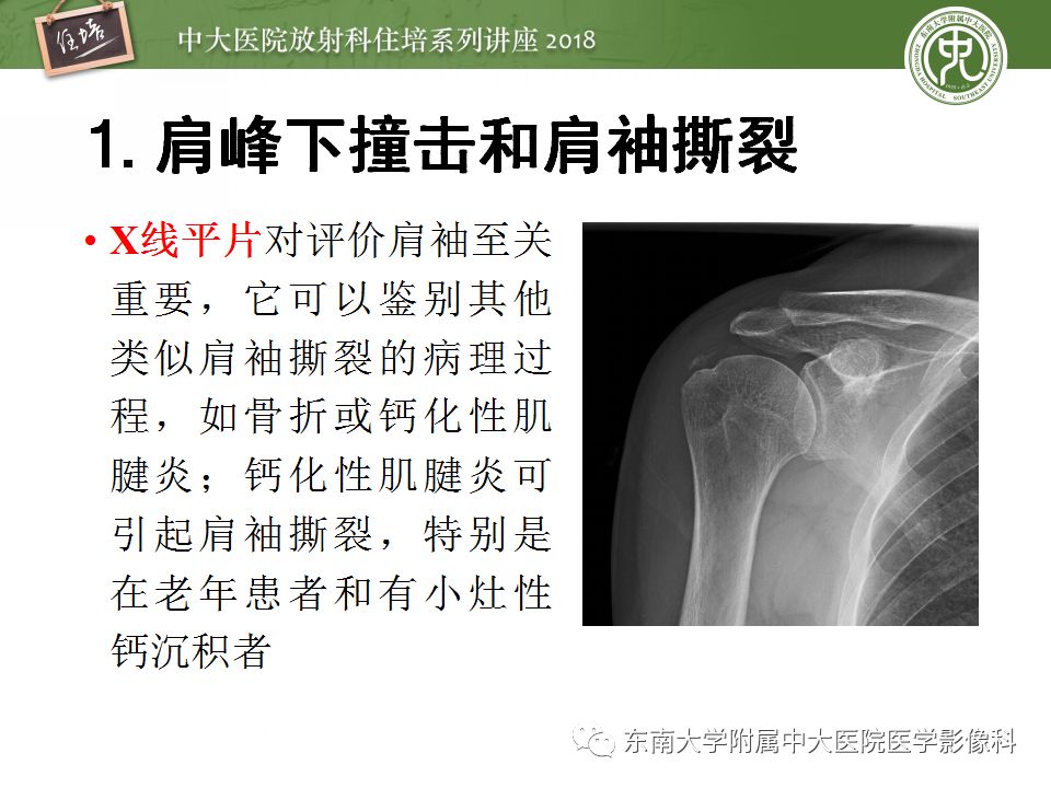 【PPT】肩关节病变影像诊断分析