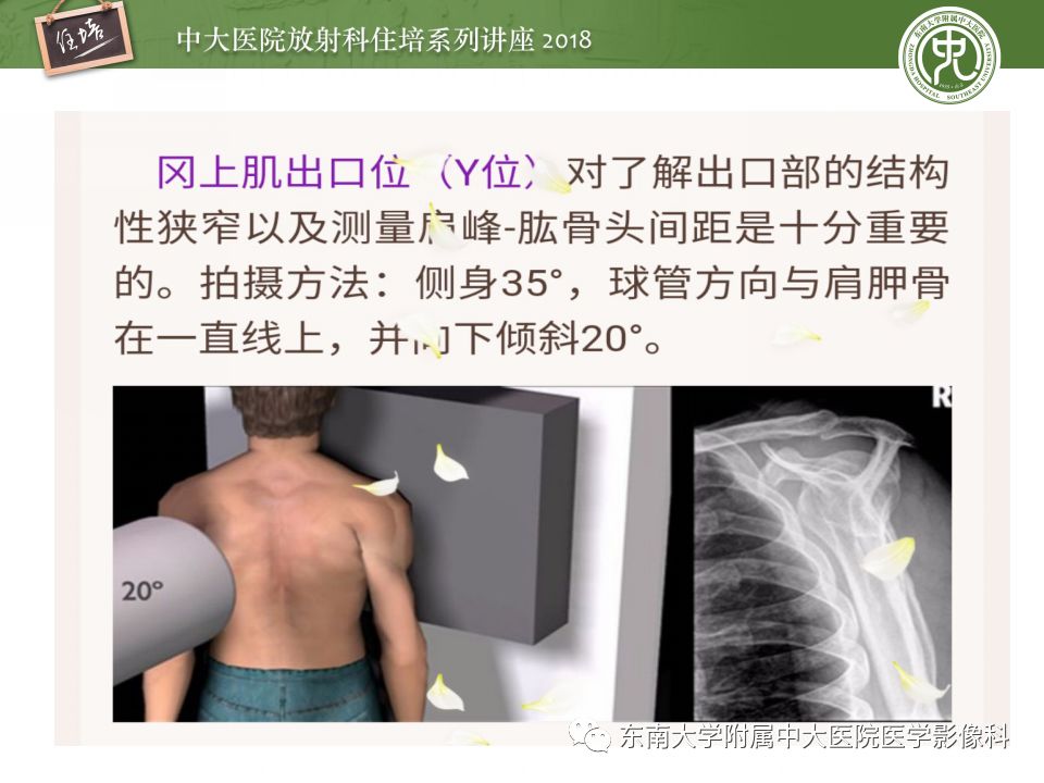 【PPT】肩关节病变影像诊断分析