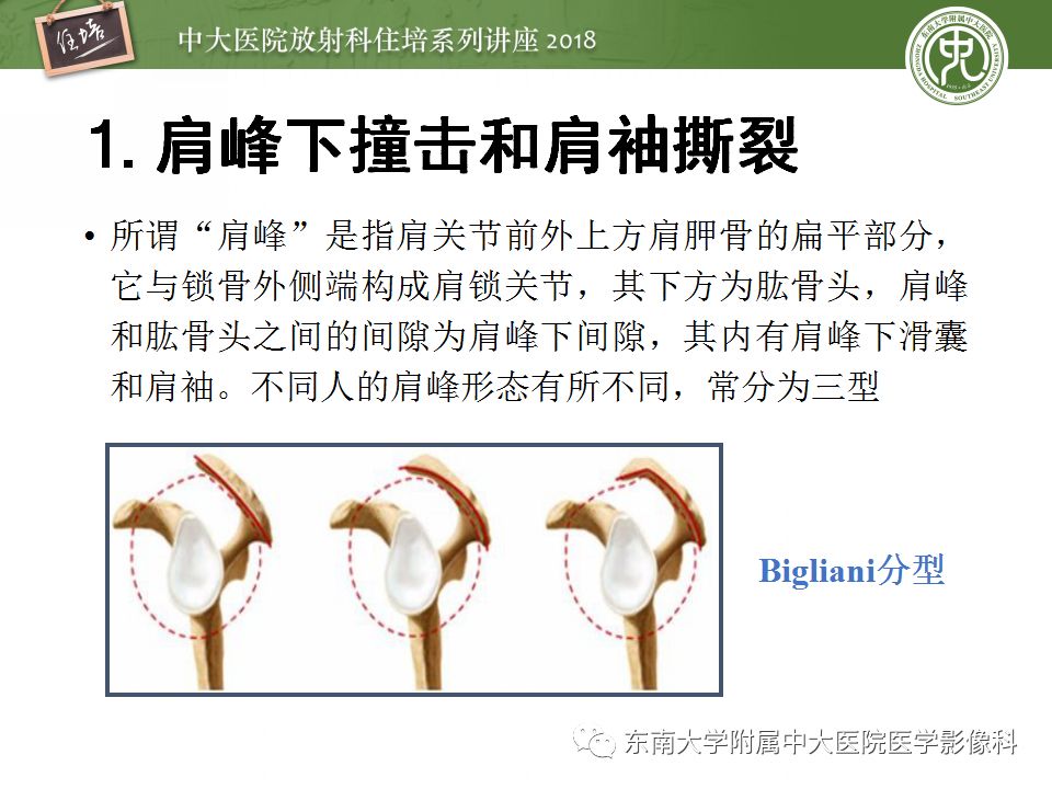 【PPT】肩关节病变影像诊断分析