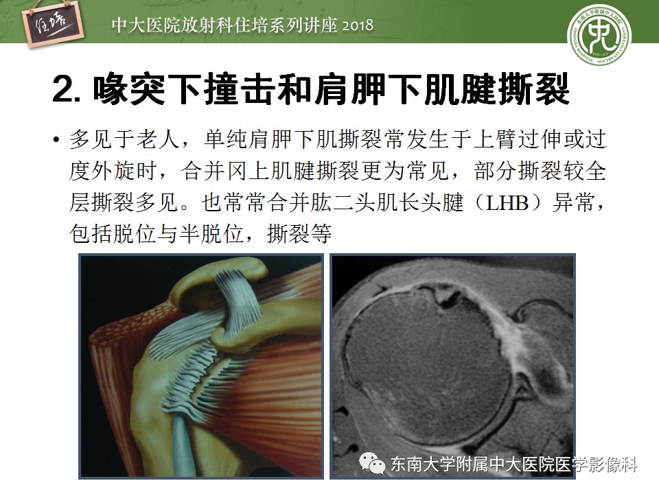 【PPT】肩关节病变影像诊断分析