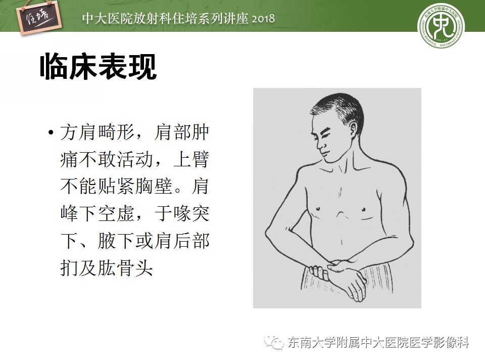 【PPT】肩关节病变影像诊断分析