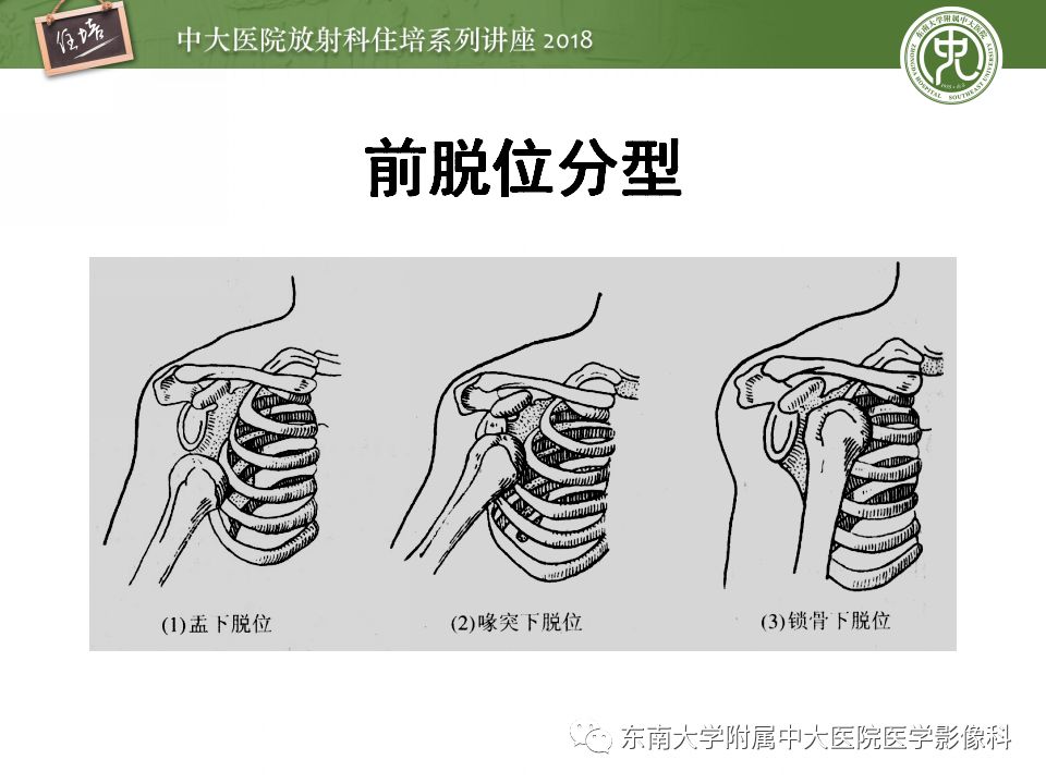 【PPT】肩关节病变影像诊断分析