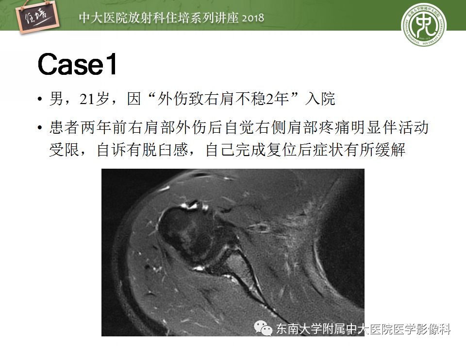 【PPT】肩关节病变影像诊断分析