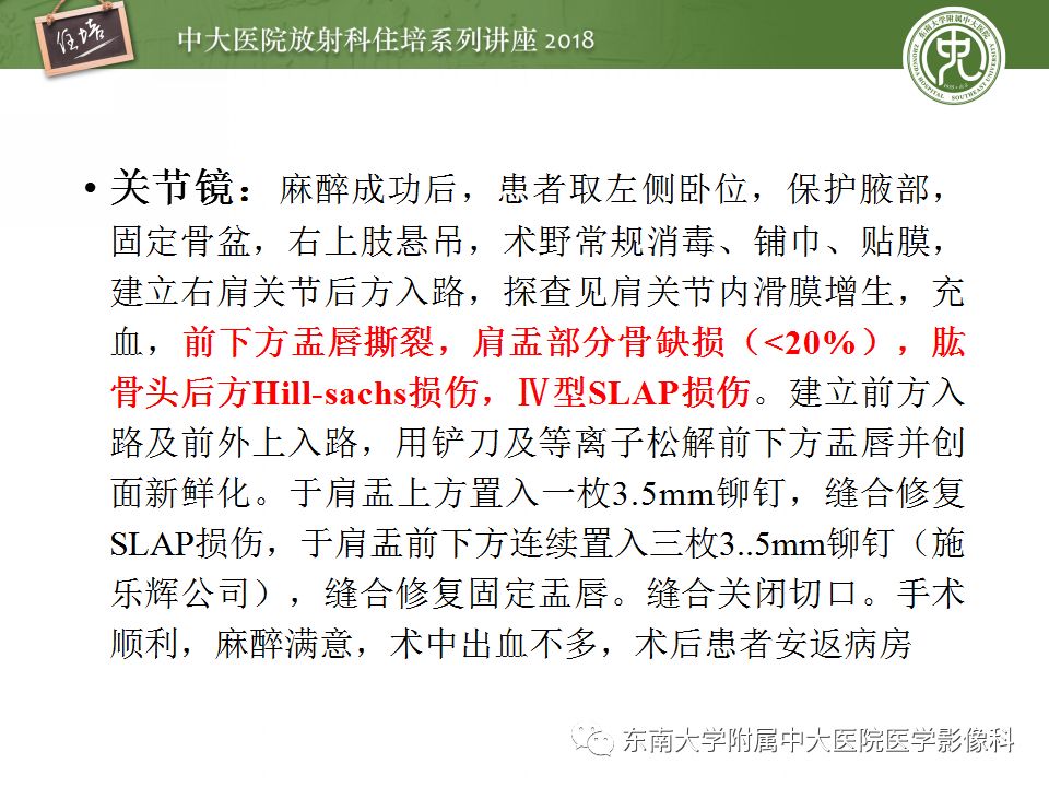 【PPT】肩关节病变影像诊断分析