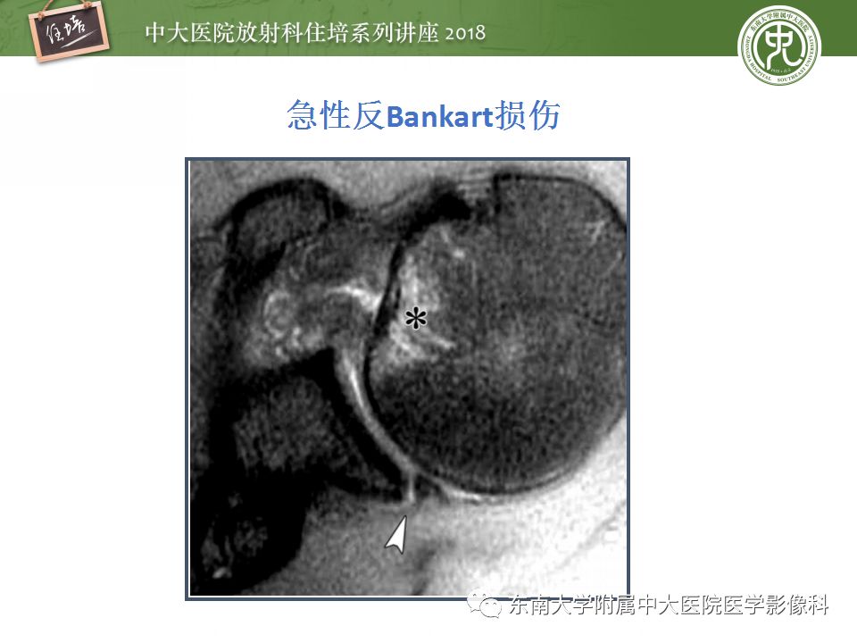 【PPT】肩关节病变影像诊断分析