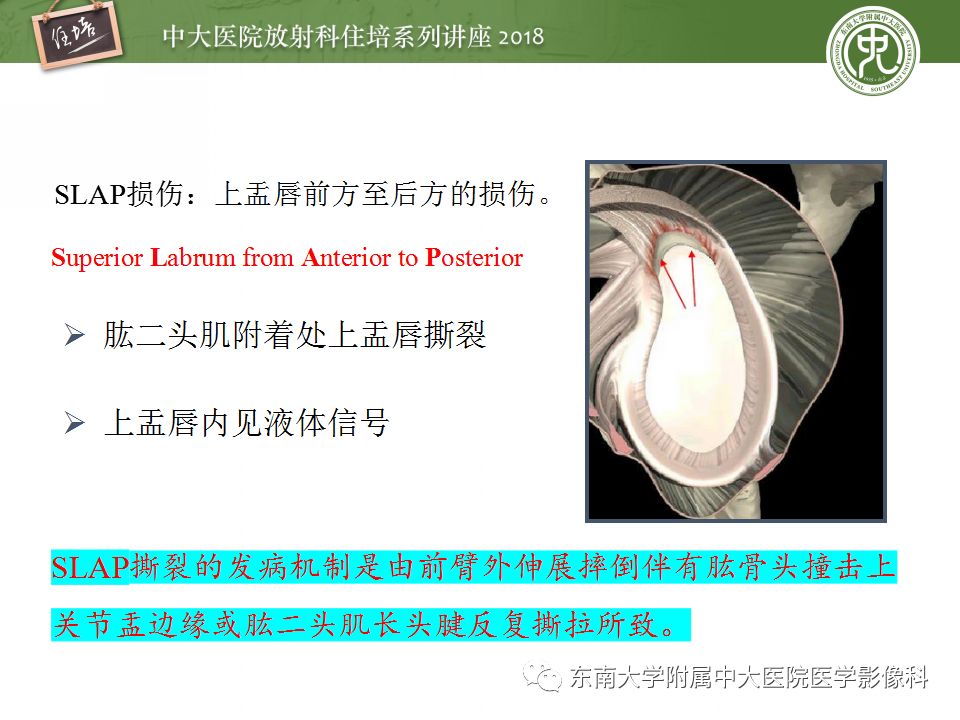 【PPT】肩关节病变影像诊断分析