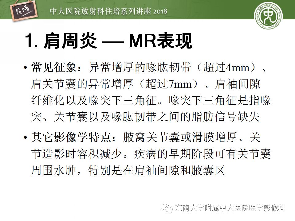 【PPT】肩关节病变影像诊断分析