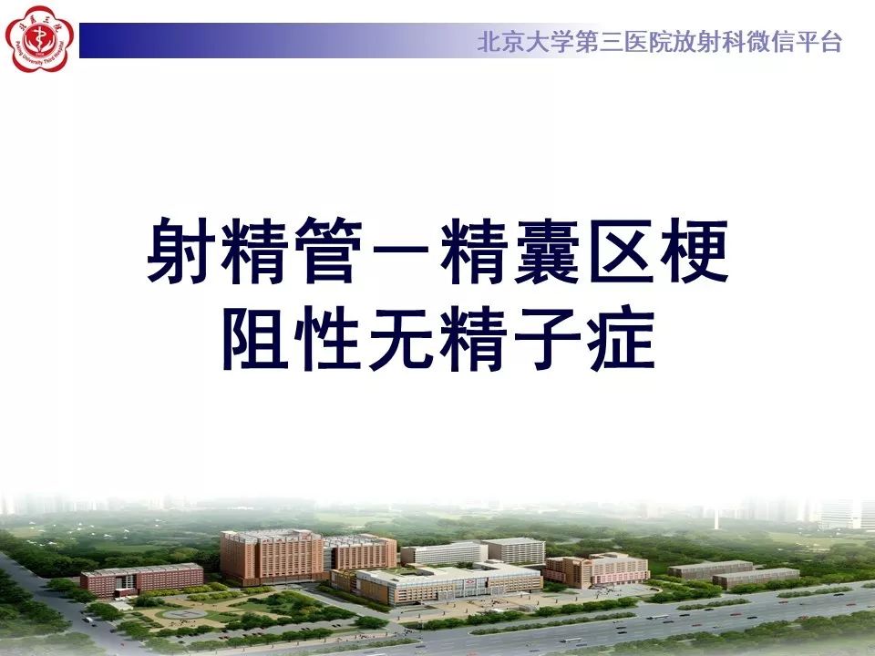 【PPT】射精管-精囊区梗阻性无精子症