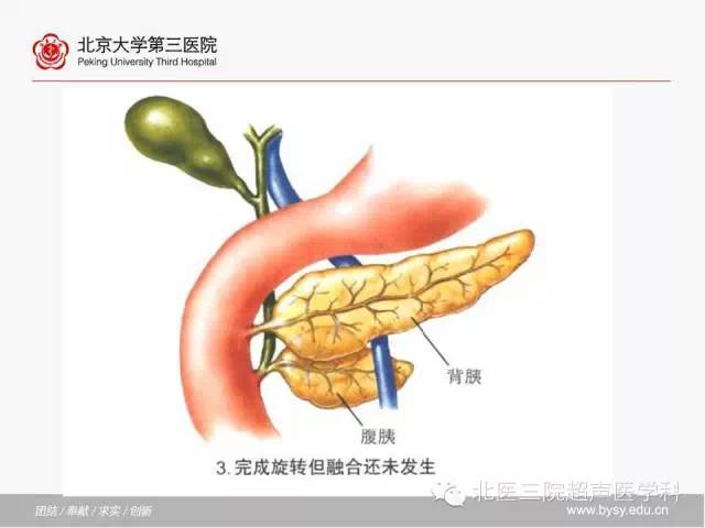 【PPT】胰腺常见解剖变异及影像学表现