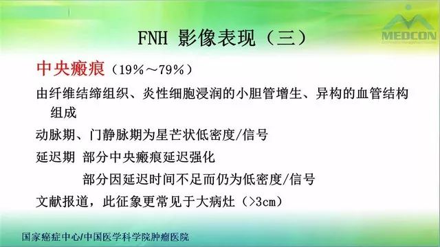 【PPT】肝脏局灶性结节增生（FNH）影像诊断及进展