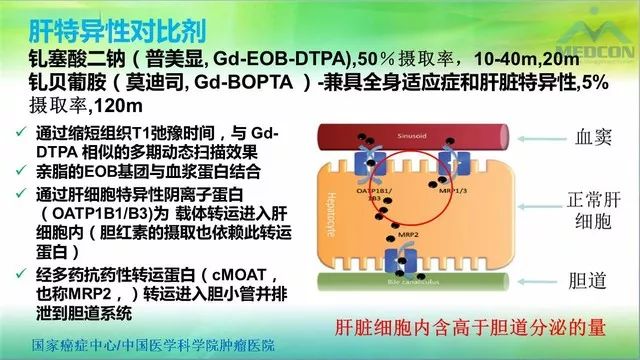 【PPT】肝脏局灶性结节增生（FNH）影像诊断及进展