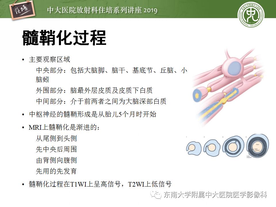 【PPT】小儿脑发育的MRI表现