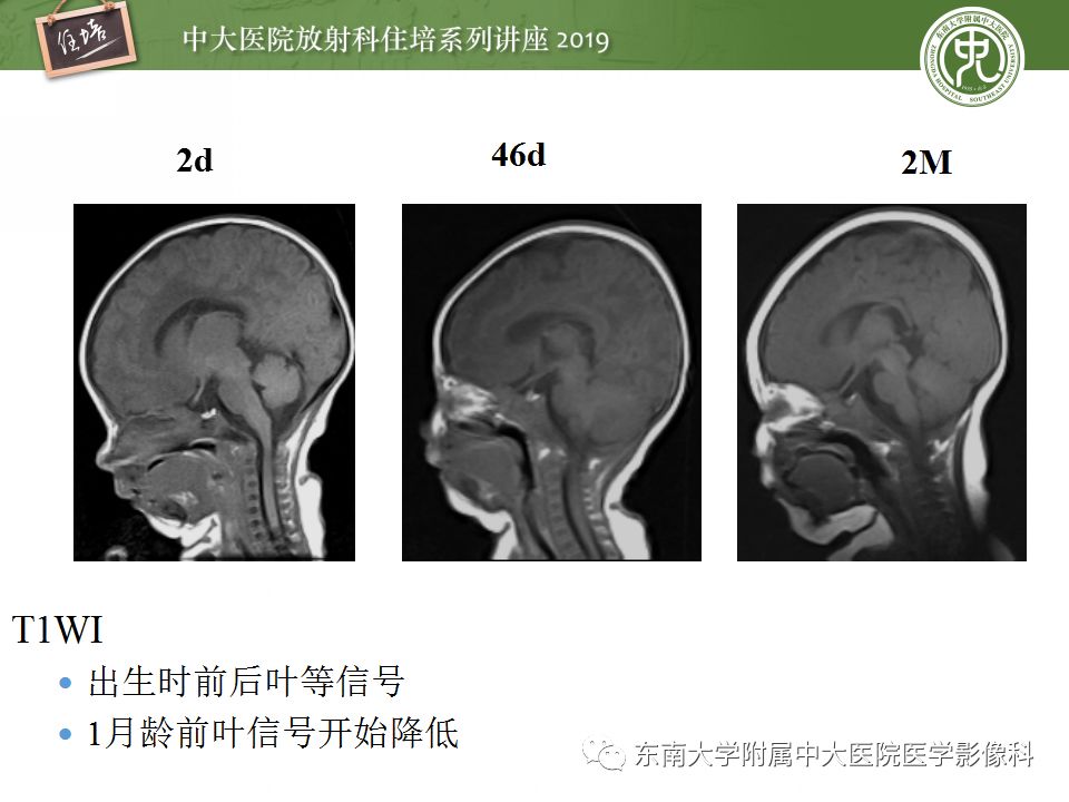【PPT】小儿脑发育的MRI表现