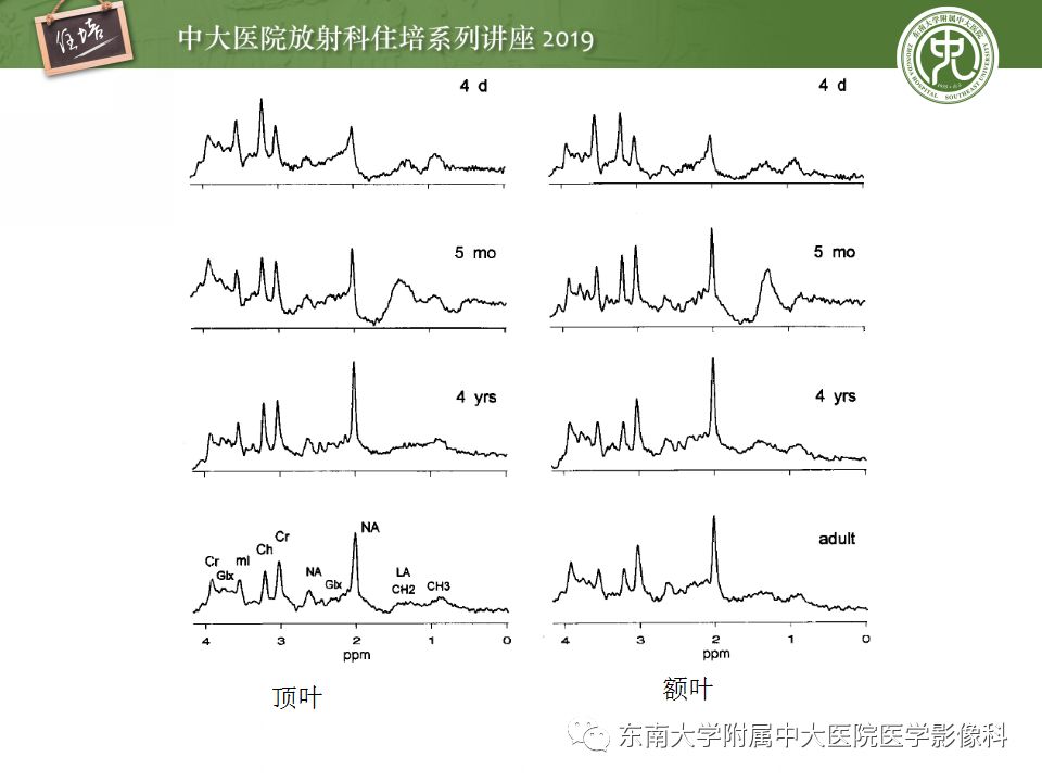 【PPT】小儿脑发育的MRI表现