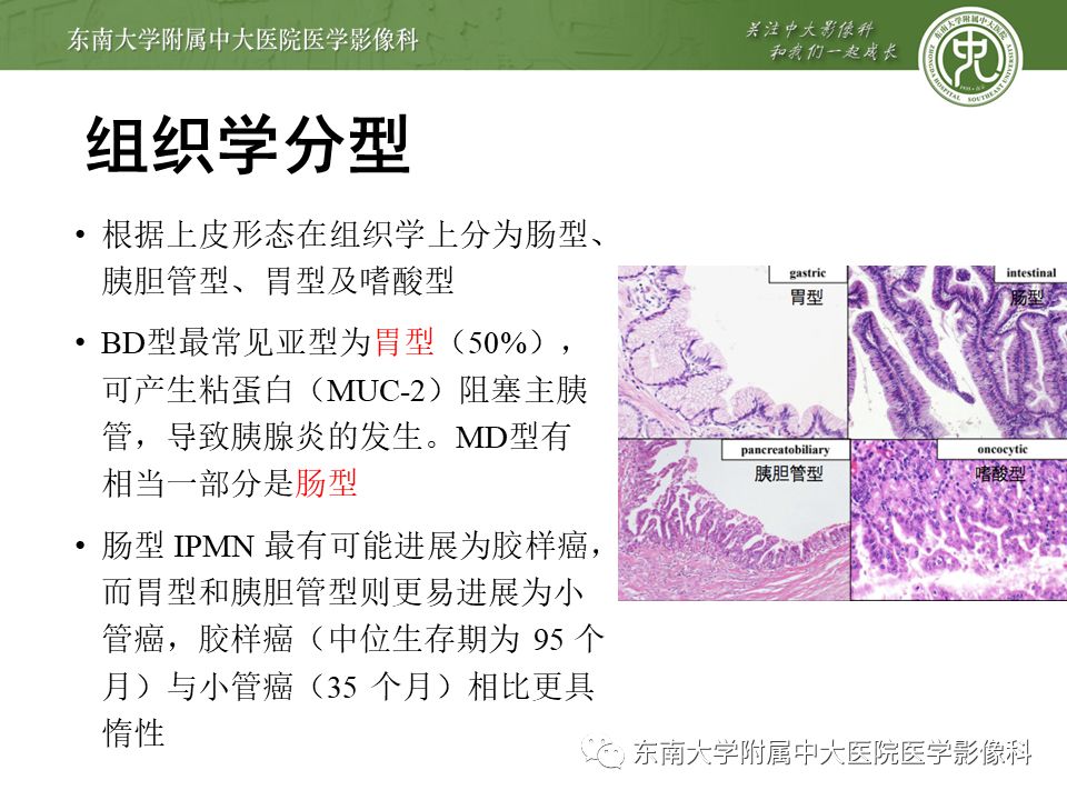 【病例】胰腺导管内乳头状瘤1例CT