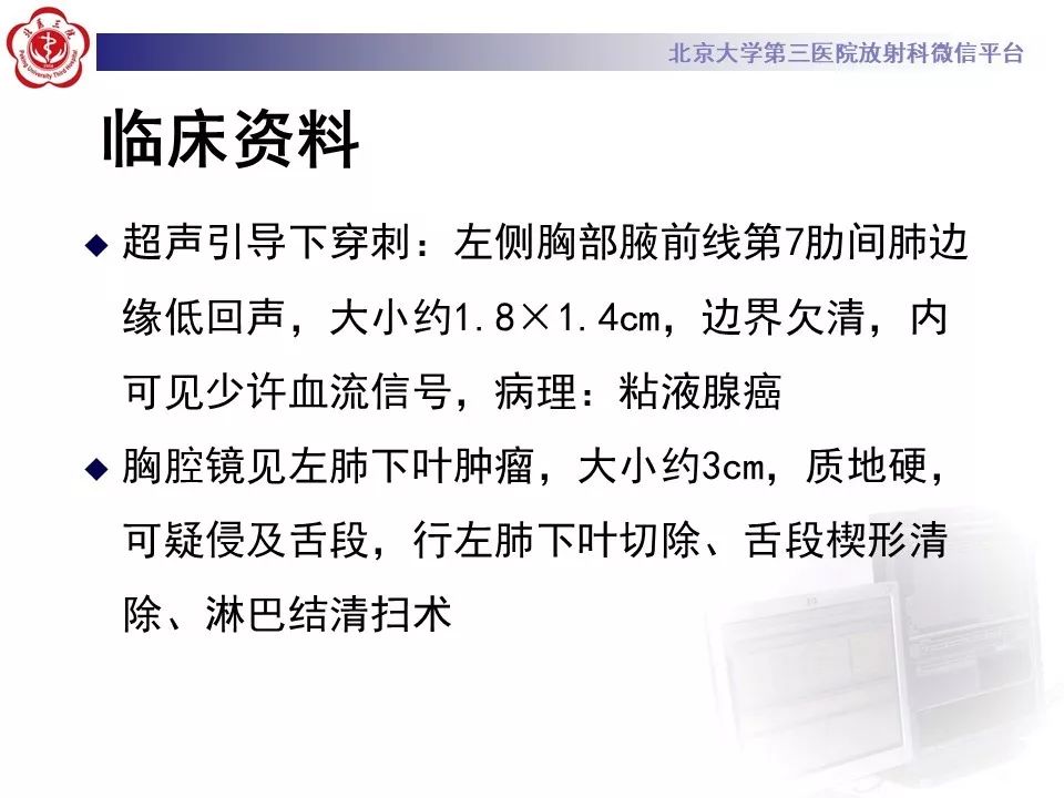 【病例】肺侵袭性粘液腺癌1例CT