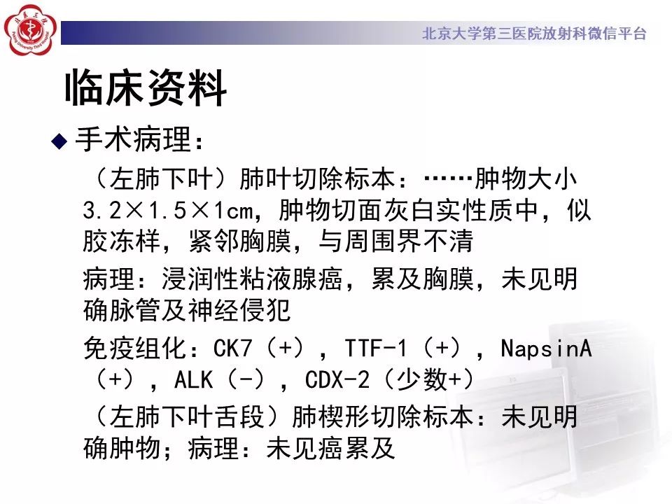 【病例】肺侵袭性粘液腺癌1例CT