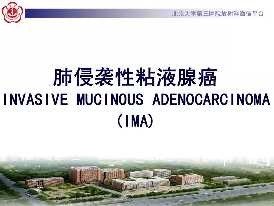 【病例】肺侵袭性粘液腺癌1例CT