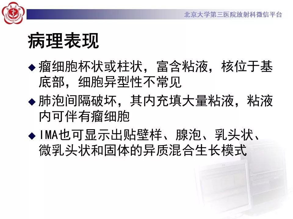【病例】肺侵袭性粘液腺癌1例CT