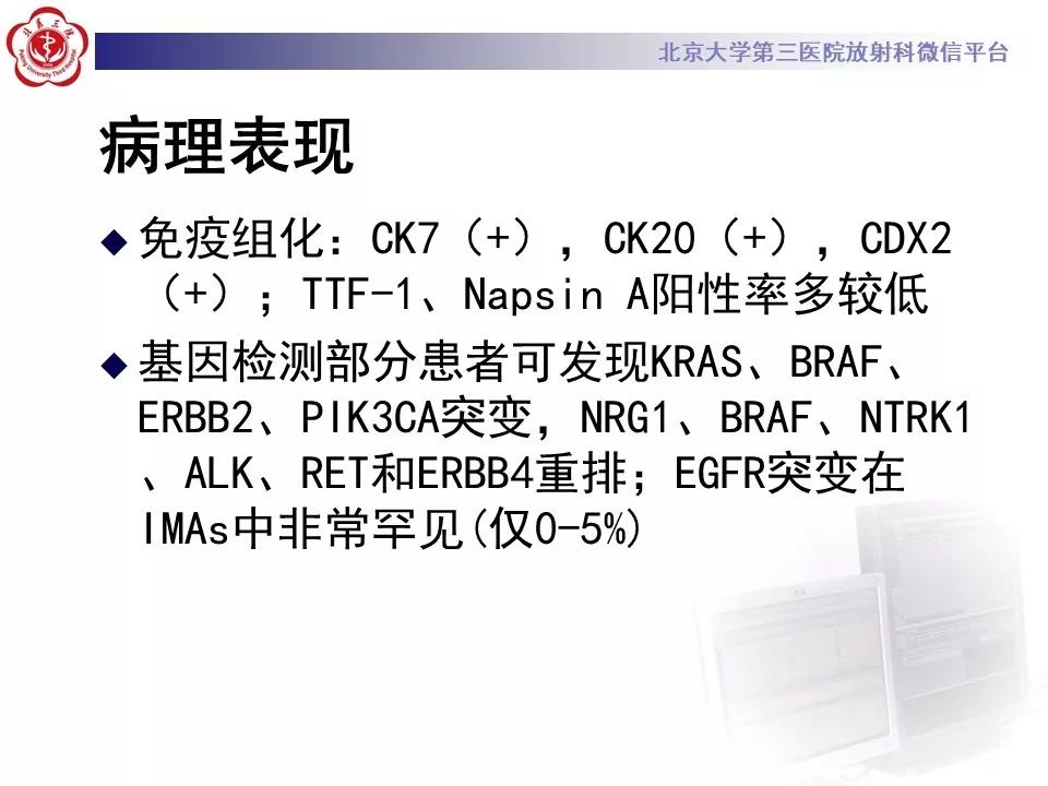 【病例】肺侵袭性粘液腺癌1例CT