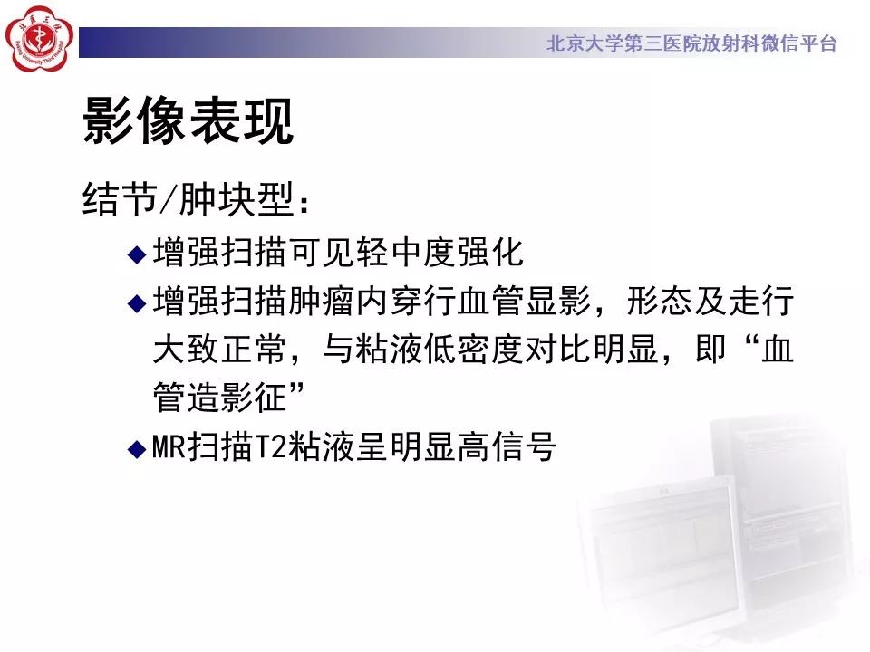 【病例】肺侵袭性粘液腺癌1例CT