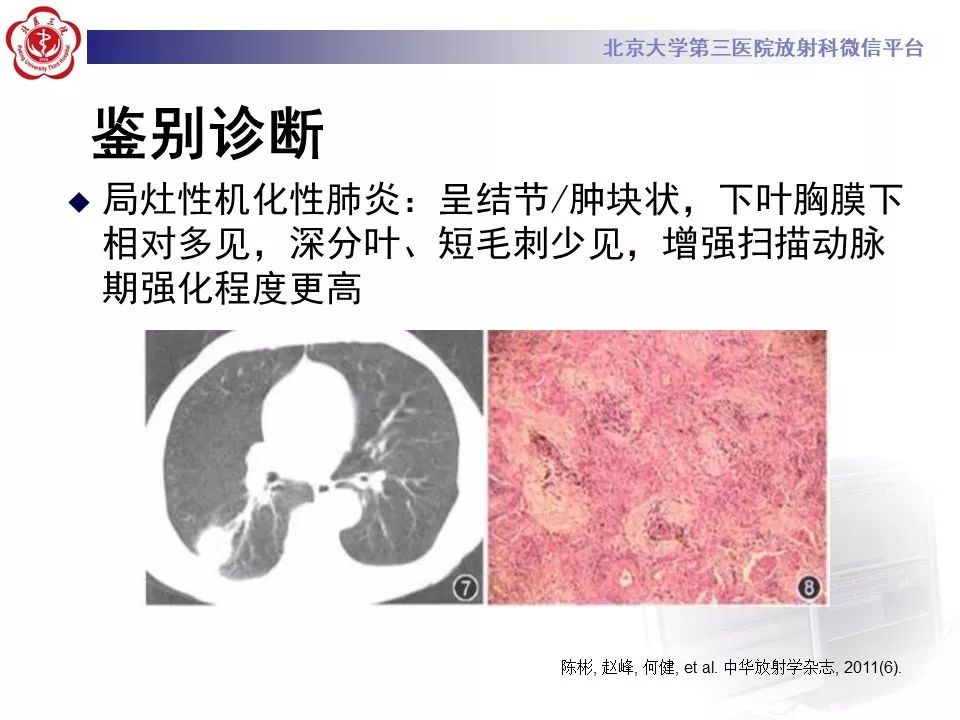【病例】肺侵袭性粘液腺癌1例CT