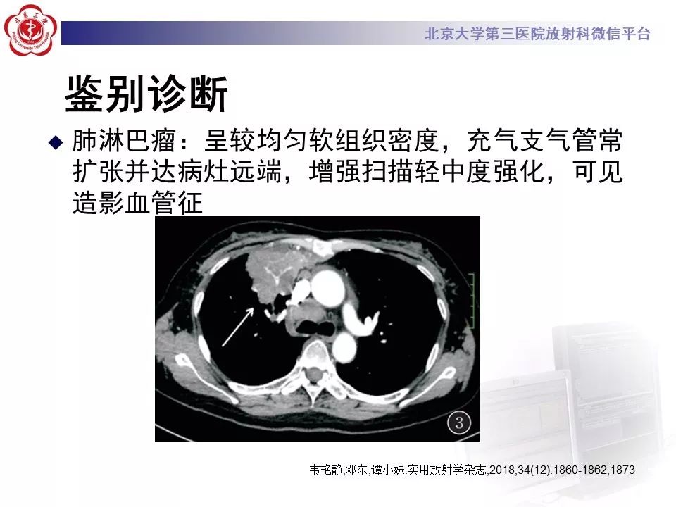 【病例】肺侵袭性粘液腺癌1例CT